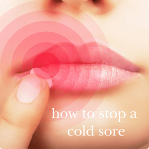 Get Rid of Cold Sores Fast Naturally