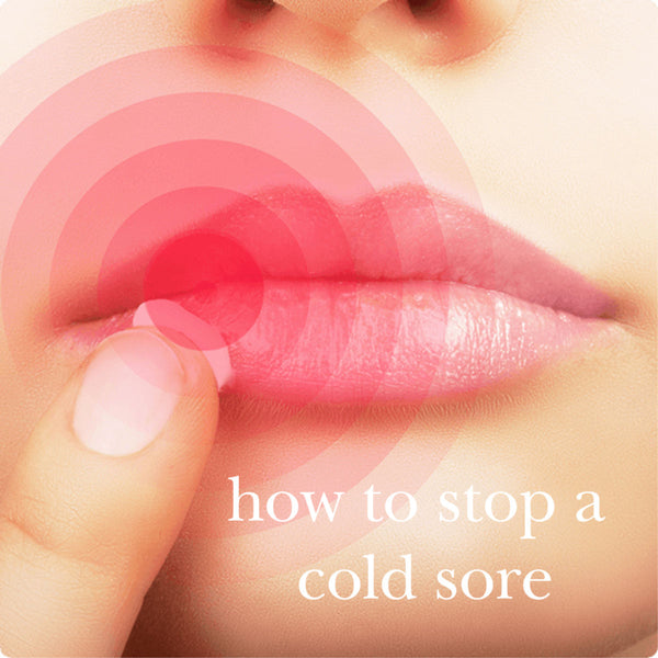 Get Rid of Cold Sores Fast Naturally Camp Wander