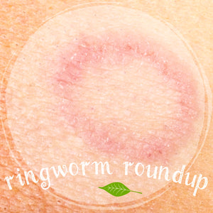 ringworm-remedy