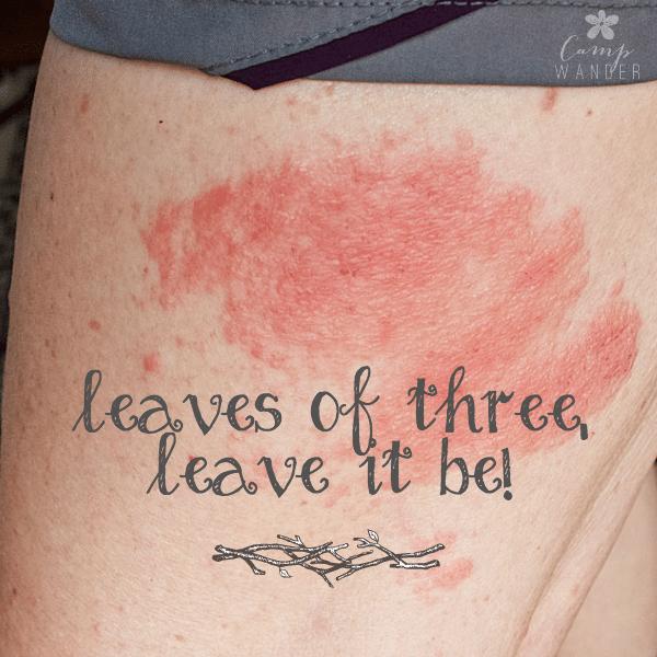 Fast Relief For Poison Ivy Encounters