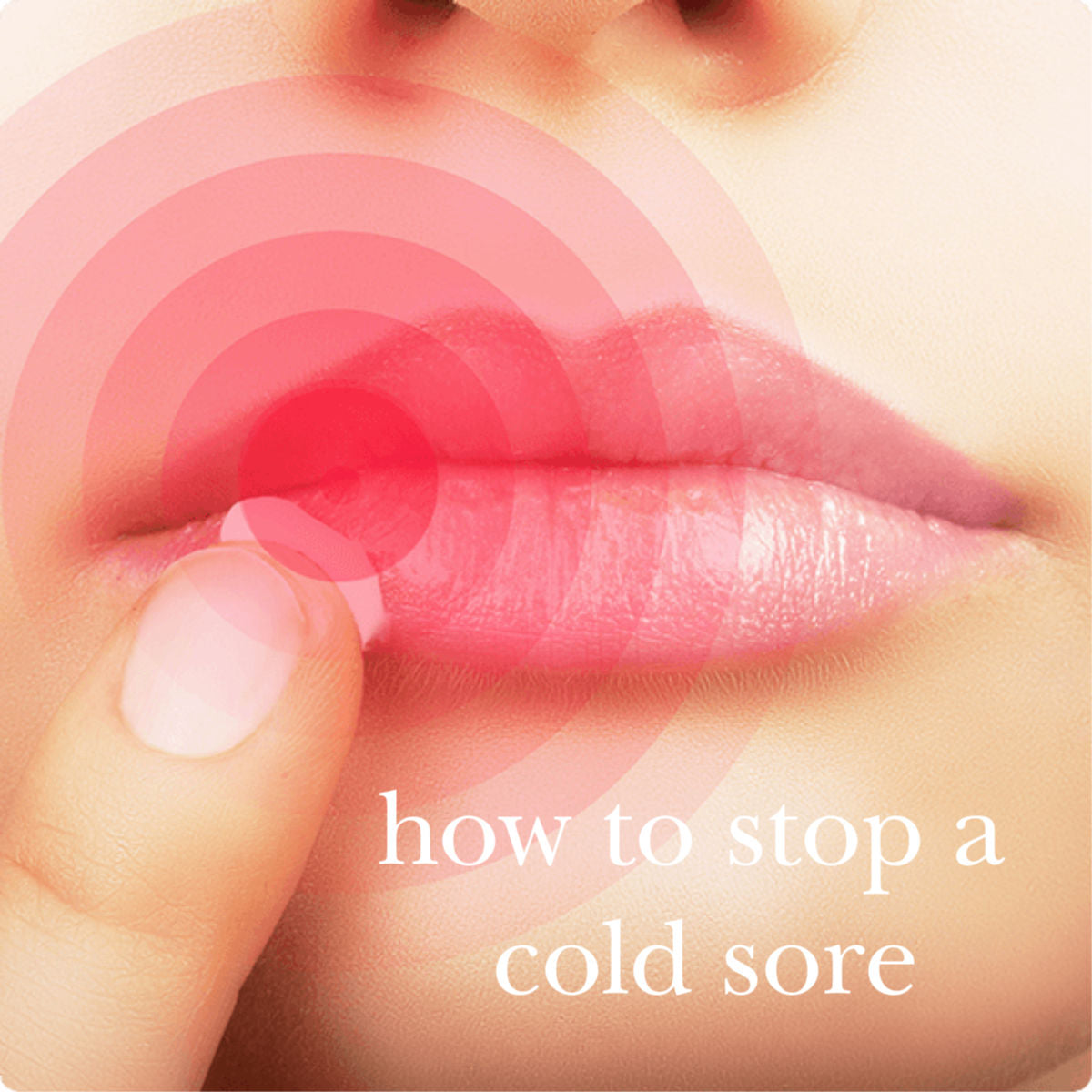 Get Rid of Cold Sores Fast Naturally Camp Wander